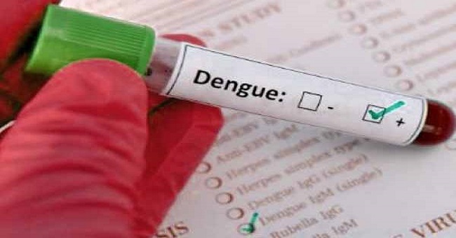 ‘डेंगू’ से निपटने के लिए स्वास्थ्य विभाग सतर्क, जारी की एडवाइजरी