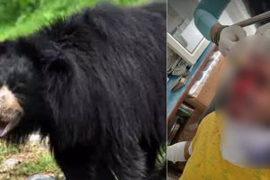 शिमला: जंगल में लकड़ी लेने जा रहे 2 युवकों पर भालुओं ने किया हमला, घायल