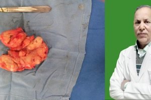 फोर्टिस कांगड़ा में लगभग आधा किलो प्रोस्टेट का सफल आपरेशन