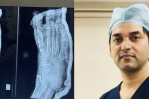 पैर के टेढ़ेपन से फोर्टिस अस्पताल कांगड़ा ने दिलाई राहत 