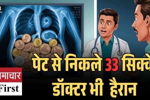 हिमाचल में अनोखा मामला: युवक के पेट से निकले 33 सिक्के, डॉक्टर भी रह गए हैरान