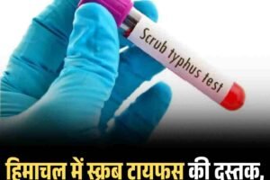 हिमाचल में स्क्रब टायफस की दस्‍तक, IGMC में पहला मामला आया सामने