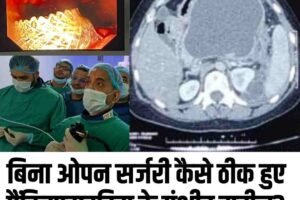 बिना ओपन सर्जरी कैसे ठीक हुए पैंक्रियाटाइटिस के गंभीर मरीज? AIMSS का चमत्कार