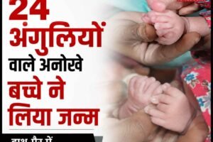 पालमपुर अस्पताल में जन्मा अनोखा बच्चा, हाथ-पैरों में छह-छह अंगुलियां
